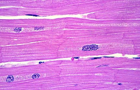 Cardiac muscle tissue is striated, branched, and has 1-2 nuclei. Cardiac muscle tissue can be recognized by intercalated disks (dark thickened part). Electrical signals at these junctions allow a wave of excitation from cell to cell, aiding in the function of the heart (see chapter 19 for more details). Cardiac muscle cells, commonly called myocytes or cardiomyocytes, are bigger than smooth muscle cells and smaller than skeletal muscle cells. They control involuntary movement (the heart). Anatomy Tissues, Cardiac Muscle Tissue, Cardiac Muscle Cell, Cardiac Muscle, Smooth Muscle Tissue, Human Cell, Histology Slides, Smooth Muscle, Tissue Types