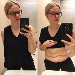 17 Women Share Pics of Loose Skin After Weight Loss to Prove How Common and Normal It Is | SELF Natural Skin Tightening, Skin Tightening Face, Excess Skin, Saggy Skin, Loose Skin, Body Positive, Daily Habits, Better Skin, Skin Tightening