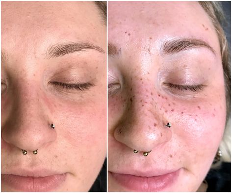 'AstroFrecks' Are Semi-Permanent Constellation Freckles and You're Gonna Want Them Constellation Freckle Tattoo, Star Freckle Tattoo, Constellation Freckles, Tattoo Freckles, Freckle Tattoo, Star Constellation Tattoo, Tattooed Freckles, Celtic Tattoo Symbols, Pretty Body