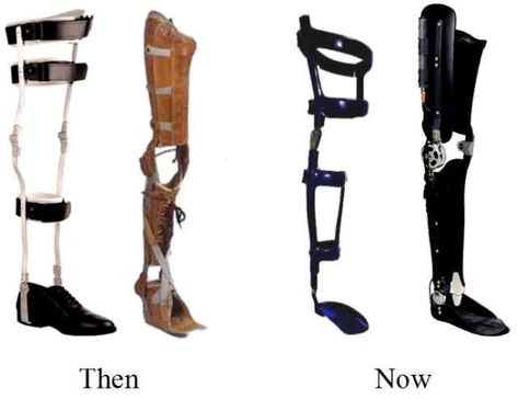 I wore the first model of brace until I was eighteen. Now I wear the last model. I was told I could have my knee fused together, so that it stayed straight all the time. Fusing my knee would be the only way I would ever get out of wearing a brace. Adaptive Devices, Leg Injury, Prosthetic Leg, Leg Braces, Leather Apron, Mobility Aids, Poor Posture, Crutches, Knee Brace