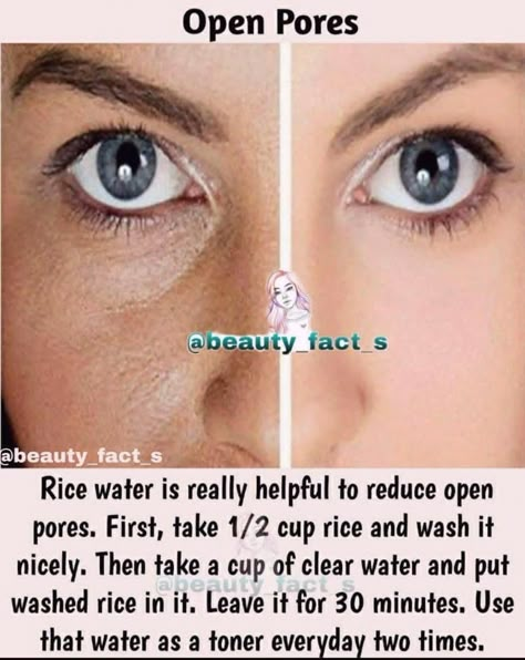 Clear Skin Face, Skin Face Mask, Clear Healthy Skin, Open Pores, Natural Skin Care Remedies, Natural Face Skin Care, Good Skin Tips, Rice Water, Beauty Tips For Glowing Skin