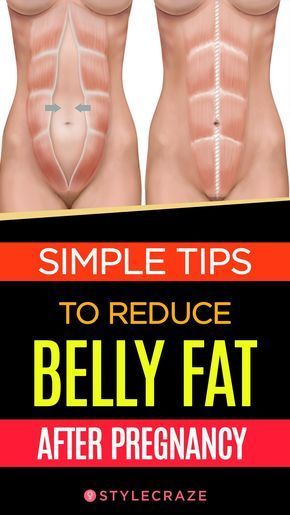 10 Simple Tips To Reduce Belly Fat After Pregnancy #women #pregnancy belly fat Pregnancy Women, Exercise Ideas, Mommy Dearest, Belly Fat Diet, Diastasis Recti, Health Nut, Stomach Fat, Post Pregnancy, Pregnant Belly