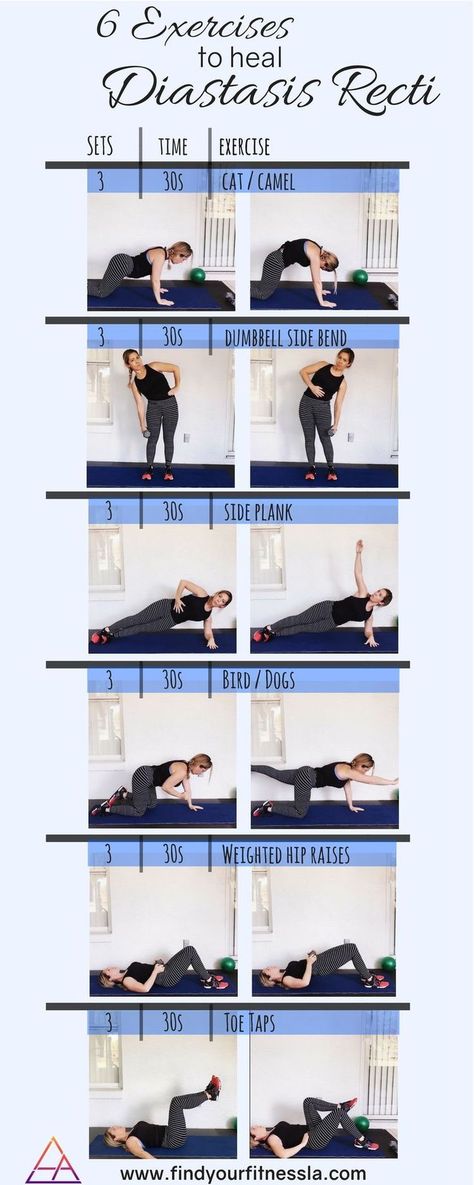 6 Exercises to heal Diastasis Recti. Prenatal and Postnatal core exercises. Tone your tummy with these 6 safe moves. No more mommy tummy, or pooch! Diastis Recti, Heal Diastasis Recti, Diástase Abdominal, Healing Diastasis Recti, Pooch Workout, Post Baby Workout, Diastasis Recti Exercises, Mommy Tummy, Post Pregnancy Workout