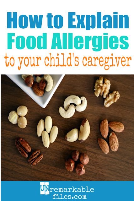 Unless they have kids with life-threatening food allergies themselves, most people won’t understand the seriousness of your child’s nut allergy. Here is how we explain our daughter’s peanut allergy to her babysitters and caregivers, to raise their awareness and keep her safe. #foodallergies #kids #children #babysitter #peanutallergy #allergic #parentingtips #unremarkablefiles Peanut Allergy Awareness, Potty Training Humor, Nut Allergy, Food Allergies Awareness, Egg Allergy, Kids Allergies, Allergy Awareness, Peanut Allergy, Discipline Kids