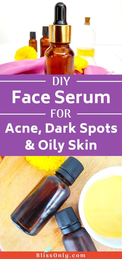 Face Serum For Acne, Diy Face Serum Recipe, Diy Face Serum, Face Serum Recipe, Serum For Acne, Oily Skin Acne, Acne Dark Spots, Acne Scar, Mild Cleanser