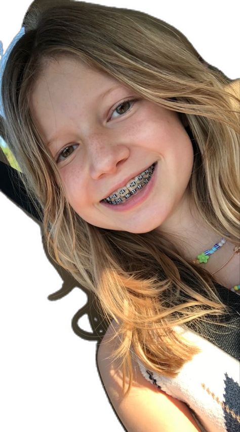 Braces Girl, Girl With Braces, Dental Braces Colors, Braces And Glasses, Girls With Braces, Cute Braces Colors, Braces Tips, Braces Girls