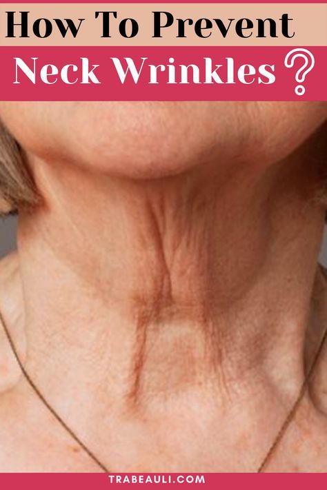 Neck wrinkles are a problem that happens to everyone at a certain age. Let's know the best ways to prevent them. Check out the blog- #neckwrinkles #homeremediesforwrinkles #wrinkles #skincare #skinproblems #remedy #preventneckwrinkles #getridofneckwrinkles Home Remedies For Wrinkles, Wrinkle Remedies, Wrinkle Free Skin, Brown Spots Removal, Neck Wrinkles, Skin Care Wrinkles, Skin Specialist, Flawless Face, Deep Wrinkles