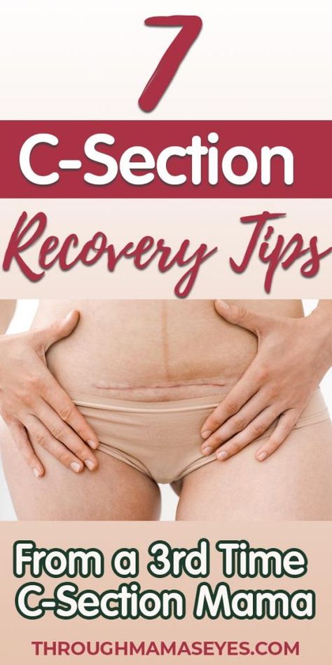 Post Csection Recovery, Discover Myself, Holistic Motherhood, Birth Recovery, Emergency C Section, C Section Scars, C Section Recovery, Cesarean Section, Postpartum Health