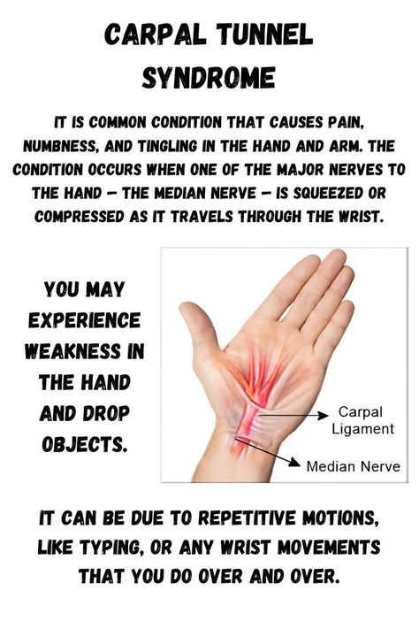 Carpal Tunnel Syndrome Carpal Tunnel Release Surgery Recovery, Carpoltunal Relief Hands, Carpultunal Wrist Relief, Carpal Tunnel Surgery Recovery, Carple Tunnel, Physiotherapy Knowledge, Carpal Tunnel Remedies, Homemade Healing Salve, Skincare Routine And Products