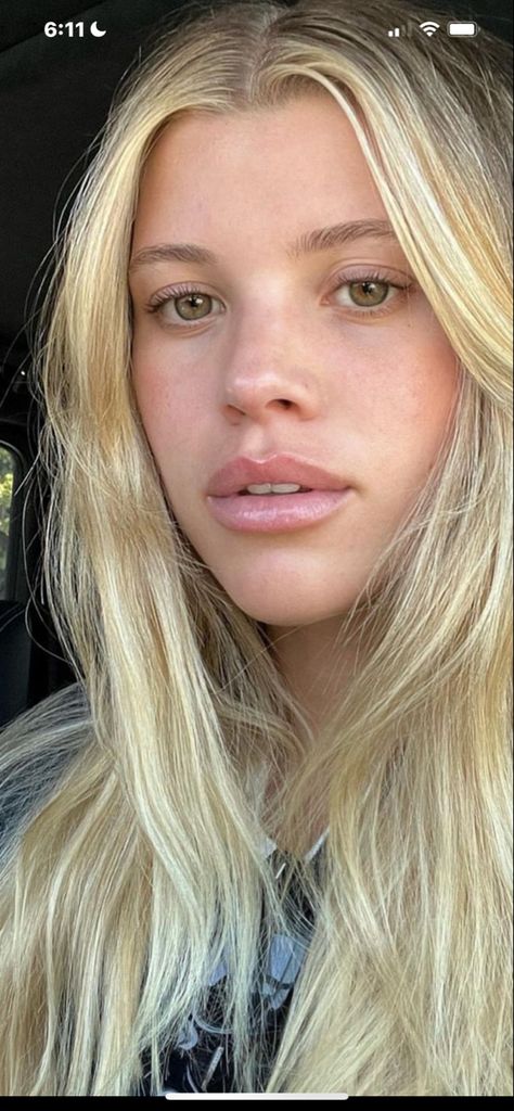 Lip injections #filler #lipfillersstyles Scandi Hairline, Scandinavian Hairline, Dermal Fillers Lips, Hyaluronic Acid Lips, Lips Inspiration, Botox Lips, Facial Aesthetics, Lip Filler, Viral On Tiktok