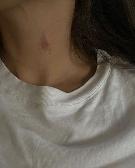 Hickies Neck Boys And Girl, Hicks On Neck, Hickies Neck, Love Bites, Couples Vibe, Selfie Ideas Instagram, Trik Fotografi, Sweet Nothings, Aesthetic Grunge