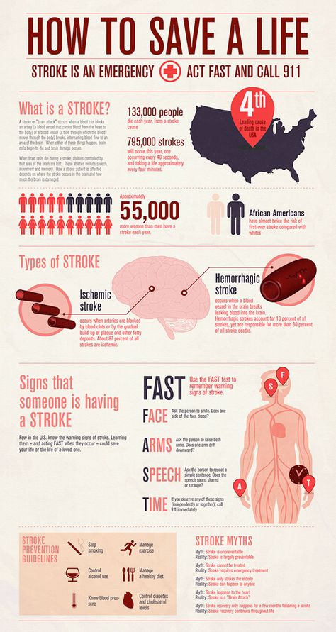 Infographic for American Stroke Prevention // 2012 on Behance Types Of Strokes, Brain Stem, Health And Fitness Magazine, Home Doctor, Daily Health Tips, Workout Chart, Brain Damage, Health Advice, Blood Vessels