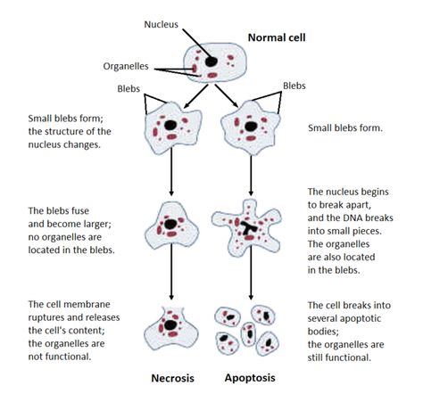 Types of Necrosis – howMed Pathology Study, Cell Organelles, Eukaryotic Cell, Veterinary School, Plasma Membrane, Degenerative Disease, Gene Therapy, T Cell, Skin Science