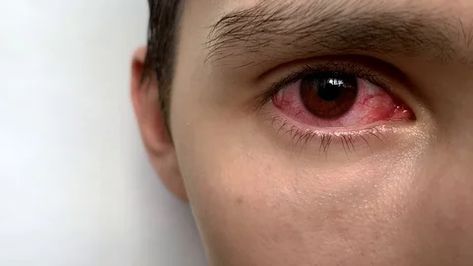 Bloodshot Eyes Aesthetic, Bloodshot Eye, Bloodshot Eyes, Eyes Aesthetic, Eye Close Up, Aesthetic Edits, Red Eye, Free Footage, Slow Motion