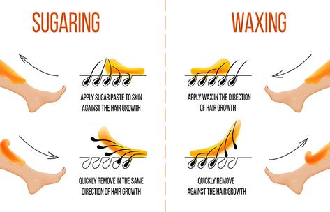 Sugaring Vs Waxing, Natural Facial Hair Removal, Waxing Tips, Homemade Facial Mask, Sugar Waxing, Hair Removal Methods, Body Hair Removal, Hair Removal Cream, Unwanted Hair Removal