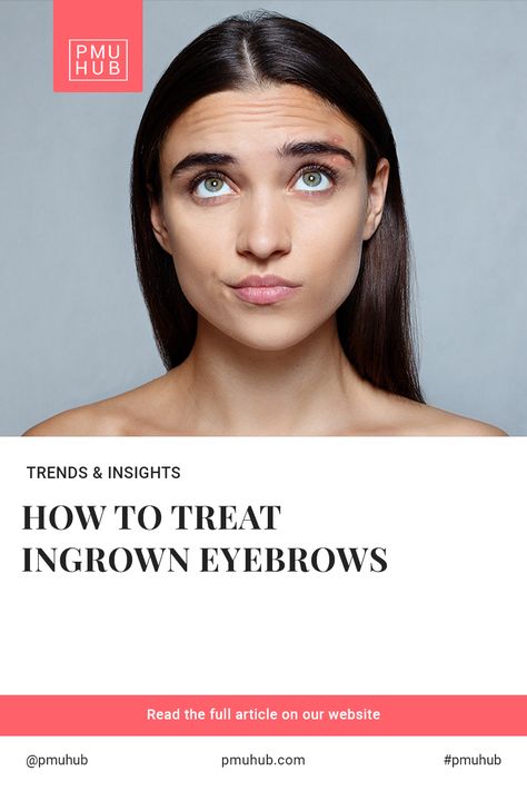 Ingrown hairs are the worst. They hurt, itch, burn, and they’re entirely impossible to ignore. When they’re also in super obvious places, like an ingrown hair in eyebrow, it can ruin your day in a snap. So, how do you deal with them? Fortunately, it’s fairly simple. Here’s why an ingrown hair in eyebrow can pop up in the first place, how to deal with it on your own, and when to ask for help. Ingrown Eyebrow Hair, Treat Ingrown Hair, Ingrown Hair Remedies, Ingrown Hair Removal, Tweezing Eyebrows, Prevent Ingrown Hairs, Ingrown Hairs, Hair Remedies, Professional Help