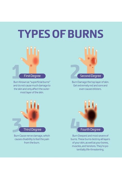 Burned Skin Drawing, Burn Wound Care, September Calendar Ideas, Burns Nursing, Burn Wound, Types Of Burns, Emt Study, Wound Care Nursing, Creative Notes