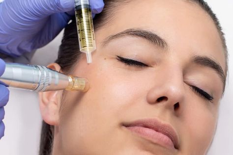 Who can perform Microneedling in North Carolina? - ÉCLAT Skin Confidence Spa Beauty Boost, Tighter Skin, Skin Tissue, Cosmetic Procedures, Anti Aging Treatments, Skin Care Treatments, Skin Healing, Permanent Makeup, Beauty Treatments