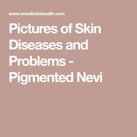 Pictures of Skin Diseases and Problems - Pigmented Nevi Skin Conditions Pictures, Skin Disease Pictures, Basal Cell, Type Of Skin, Squamous Cell, Skin Growths, Skin Condition, Skin Diseases, Aging Process