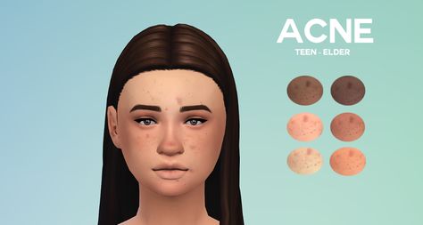 boredsimblr: Acne Now even your sims won’t have... - Fantayzia Maxis Match Ts4 Skin, Ts4mm Cc, Taemin Move, Sims Makeup, The Sims 4 Skin, The Sims 4 Pc, Skin Details, Sims 4 Mm Cc, Sims 4 Cc Makeup