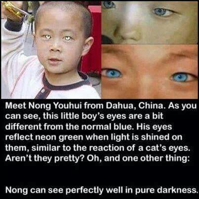 Eyes Health, Behind Blue Eyes, Creepy Facts, The More You Know, Cool Stuff, Mind Blown, His Eyes, A Child, Blue Eyes