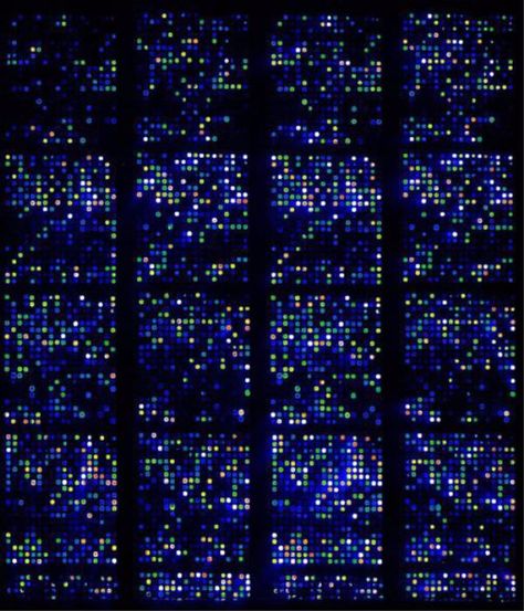 DNA microaarray. Science data, biology, Genes. Microarray analysis of genomes and transcriptomes of cell Dna Analysis, Futuristic Cities, Romanticizing Life, Interactive Art, Science Biology, Futuristic City, Medical Science, Data Science, Abstract Shapes