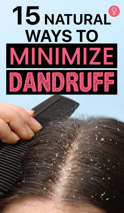 How To Remove Dandruff, Itchy Flaky Scalp, Dandruff Solutions, Home Remedies For Dandruff, Dandruff Remedy, Getting Rid Of Dandruff, Underarm Hair Removal, Hair Dandruff, Hair Control