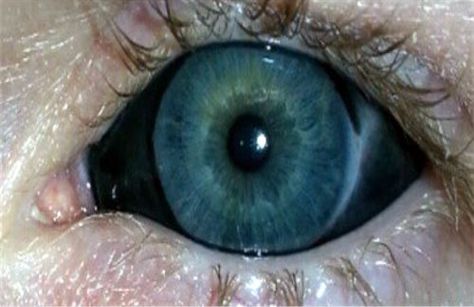 A close up of a white person's blue eye with the sclera tattooed black. Sclera Tattoo, Black Sclera, Toshinori Yagi, Dragon Kid, Monster Prom, Mad Science, Chaotic Neutral, Mad Scientist, Body Modifications