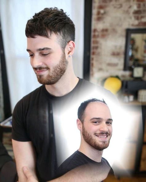 45 Men Before And After Getting Non Surgical Hair Replacements By Phil Ring Hair Pieces For Men, Hair Replacement For Men, Balding Men, Haircuts For Balding Men, Hair Replacement Systems, Luxurious Hair, Mens Wigs, Bald Men, Hair System