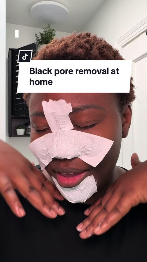 Blackhead Be Gone: Your Comprehensive Guide #Blackheads #skincare #blackheadremoval #cleanser #facecleanser #beautyhacks How To Remove Blackheads, Blackhead Remedies, To Remove Blackheads, Prevent Pimples, Blackhead Removal, Remove Blackheads, Clear Skin Tips, Clear Complexion, Skin Secrets