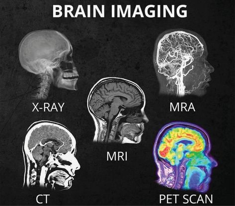 Home - San Diego Brain Injury Foundation Radiology Student, Brain Images, Pet Scan, Brain Facts, Medical Student Study, Brain Scan, Medical School Inspiration, Medical School Studying, Medical School Essentials