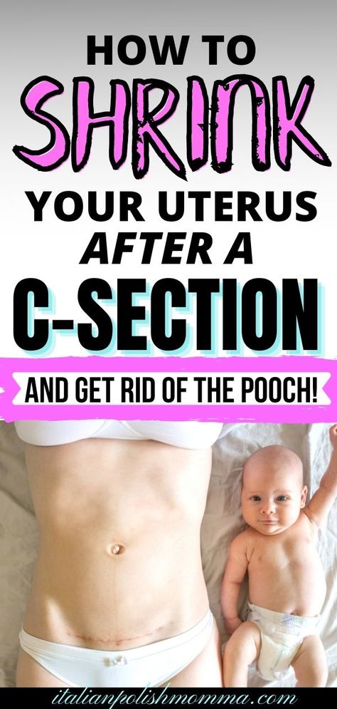 Want to know how to lose the c-section belly pooch and shrink your uterus fast? Find out how to shrink your uterus safely after birth and lose the c-section belly! Postpartum c-section tips from a mom that had 4 c-sections! | shrink uterus | postpartum belly | c-section recovery | c-section belly | C Section Pouch, C Section Belly, After C Section Workout, C Section Workout, Body After Baby, Loose Belly, C Section Recovery, Post Pregnancy Workout, Losing 40 Pounds