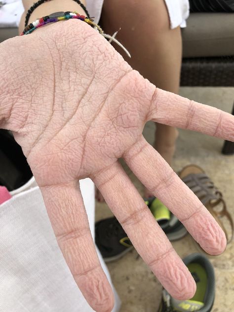 My friend has her entire hand wrinkling after a few minutes in the pool Wrinkles Hands, In The Pool, Simple Things, The Pool, My Friend, Pool, Water, Quick Saves