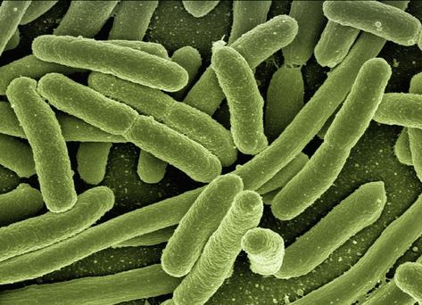 Escherichia coli, also known as E. coli, is a facultative anaerobic, rod-shaped bacterium of the genus Escherichia that is commonly found in the intestine of warm-blooded organisms. . E coli has been shown to evade the host innate immune response by suppressing NF-κB activation in cells, which results in decreased cytokine secretion and increased cellular apoptosis. . Follow my Facebook page : https://www.facebook.com/InspectingImmunology Subscribe to YouTube Channel : Gut Bacteria, Healthy Brain, Bacterial Infection, Gut Microbiome, Fungal Infection, Urinary Tract, Microbiology, Stevia, Probiotics