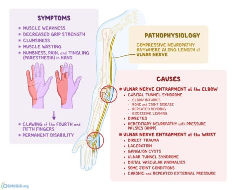 Ulnar Nerve Exercises, Cubital Tunnel Syndrome, Nerve Conduction Study, Ulnar Nerve, Basic Anatomy And Physiology, Peripheral Nerve, Muscular System, Medical School Essentials, Muscle Anatomy