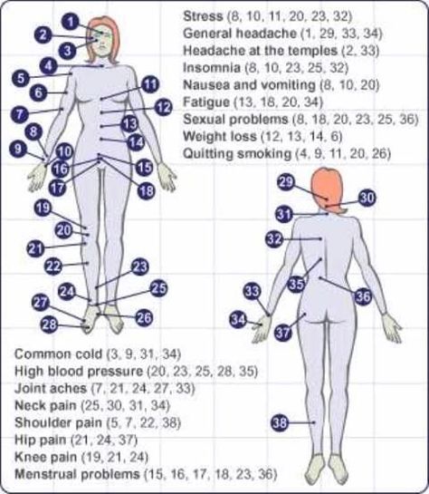 Cupping Points, Acupressure Points Chart, Acupuncture Charts, Punkty Spustowe, Shiatsu Massage Acupressure, Acupuncture Benefits, Cupping Massage, Point Acupuncture, Acupressure Therapy