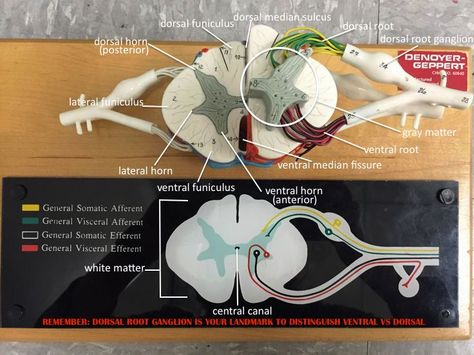 Spinal Cord Labeled, Veterinary Neurology, Spinal Nerves Anatomy, Spinal Cord Anatomy, Anatomy Lab, Nervous System Anatomy, Nerve Anatomy, Medical Student Motivation, Brain Facts