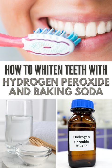 Peroxide And Baking Soda, Hydrogen Peroxide Teeth, Baking Soda Hydrogen Peroxide, Baking Soda Teeth, Natural Teeth Whitening Diy, Teeth Whiting At Home, Peroxide Teeth Whitening, Baking Soda Teeth Whitening, Baking Soda Toothpaste