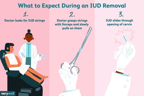 Mirena Iud Removal, Hidden Illness, Iud Side Effects, Iud Removal, Mirena Iud, Iud Insertion, Copper Iud, Nursing Diagnosis, Medical Posters