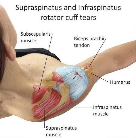 Biceps Brachii Muscle, Subscapularis Muscle, Infraspinatus Muscle, Rotator Cuff Pain, Punkty Spustowe, Shoulder Rehab Exercises, Shoulder Anatomy, Rotator Cuff Surgery, Rotator Cuff Exercises