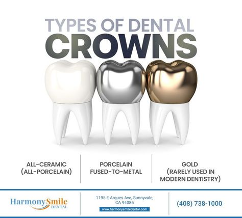 Dental crowns help preserve severely damaged or decayed teeth. The material selected is determined on your unique needs. Visit our website at http://HarmonySmileDental.com to learn more about crowns. #dentalcrown #harmonysmiledental #sunnyvale #CA Holistic Dentistry, Family Dental Care, Family Dentist, Dental Art, Dental Center, Dental Crowns, Family Dental, General Dentistry, Family Dentistry