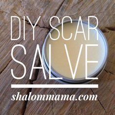 Nourish and reduce the appearance of scars with this DIY Scar Salve. Diy Scar Removal Remedies, Beginner Herbalist, Scar Remedies, Trending Diy, Acne Tips, Oils For Scars, Acne Cleanser, Acne Scarring, Scar Remover