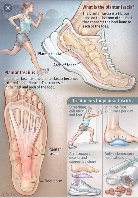 Punkty Spustowe, Plantar Fascitis, Physiotherapy Clinic, Human Body Anatomy, Muscle Anatomy, Human Anatomy And Physiology, Medical Anatomy, Body Anatomy, Medical Knowledge