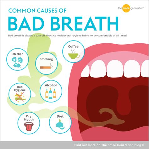 Chronic Bad Breath, Causes Of Bad Breath, Dental Quotes, Dental Posts, Dental Posters, Dental Fun, Dental Facts, Dental Marketing, Dental Services