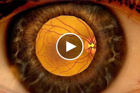 Anatomy Of Eye, Astigmatism Eye, Bionic Eye, Eye Structure, Eye Anatomy, Baby Ultrasound, Medical Videos, Vision Loss, Vision Eye