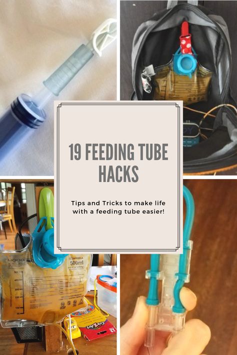 Are you new to tubie life and overwhelmed? Maybe you’re a long-time feeding tube user, but looking for some new ideas? These essential feeding tube hacks will make life with a feeding tube ju… Mickey Button Feeding Tube, Feeding Tube Accessories, Diy Feeding Tube Backpack, Ng Tube Baby Hacks, J Tube Feeding, Tube Feeding Hacks, G Tube Organization, Gtube Feeding Recipes, G Tube Feeding