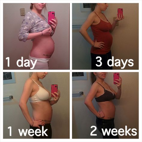 My postpartum body, go to blog to see 3 week progress.. #bodyafterbaby #postpartum #real Postpartum Bodies, Post Baby Workout, Post Pregnancy Body, Body After Baby, Baby Workout, Pregnancy Body, Post Baby Body, Fit Mama, Postpartum Body