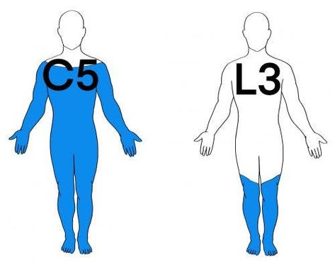 Spinal Cord Lesions, Spinal Cord Injuries, Neural Connections, Spinal Injury, Swollen Legs, Injury Recovery, Stem Cell Therapy, Cell Therapy, Nerve Damage