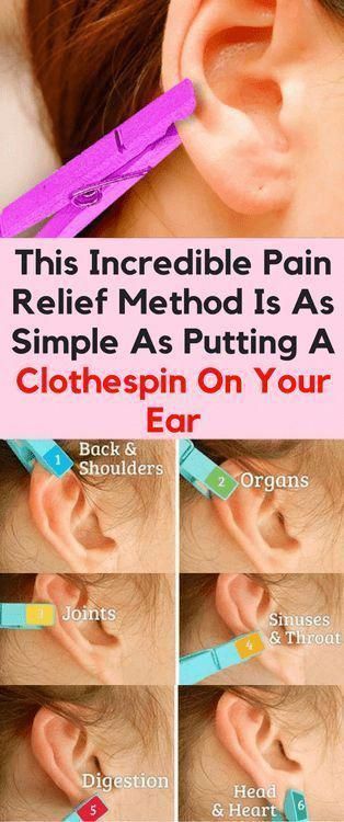 Ear Reflexology, Bolesti Chrbta, Acupressure Points, Natural Health Remedies, Back Pain Relief, Reflexology, Health Info, Health And Beauty Tips, Acupressure