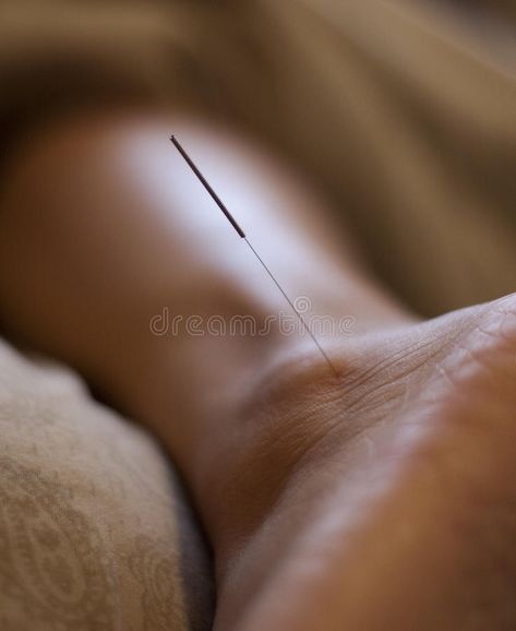 Acupuncture Needle. Acupuncture is the procedure of inserting and manipulating f , #Sponsored, #inserting, #manipulating, #procedure, #Acupuncture, #Needle #ad Acupuncture Needle, Acupuncture Needles, Acupuncture, Graphics Design, Design Branding, Book Covers, Portland, Oregon, Medicine